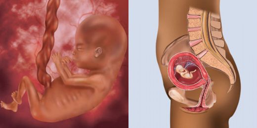 10 Haftalık Gebelikte Kanama Nedenleri?