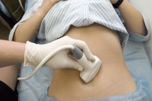 2 Aylık Hamilelikte (Gebelikte) Kanama Belirtileri ve Tedavisi