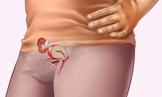 3 Haftalık Gebelikte Kanama Nedenleri?