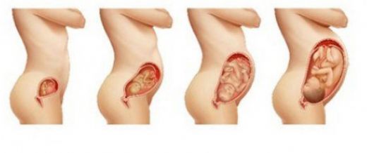 4 Aylık Gebelikte (Hamilelikte) Kanama Nedenleri?