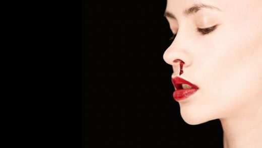 Aşırı Burun Kanaması Belirtileri ve Tedavisi