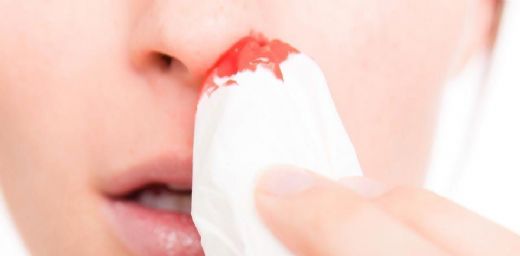 Burun Kanaması Neye İşarettir?