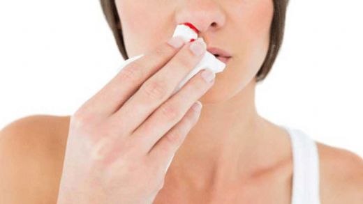 Burun Kanaması ve Baş Ağrısı Belirtileri ve Tedavisi