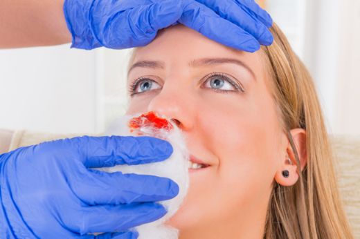 Durduk Yere Burun Kanaması Belirtileri ve Tedavisi