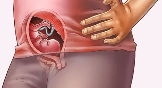 Hamilelikte Kahverengi Kanama Belirtileri ve Tedavisi