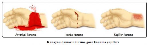 Kanama Durdurma Yöntemleri