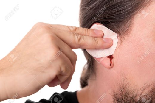 Kulak Kanaması Belirtileri ve Tedavisi