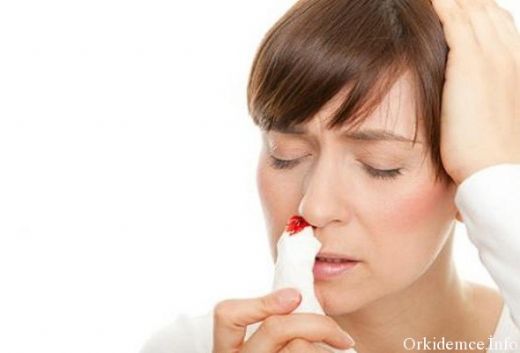 Tek Taraflı Burun Kanaması Belirtileri ve Tedavisi