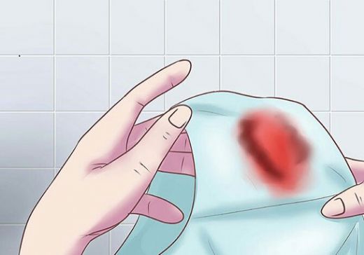 Yumurtlama Döneminde Kanama Nedenleri?